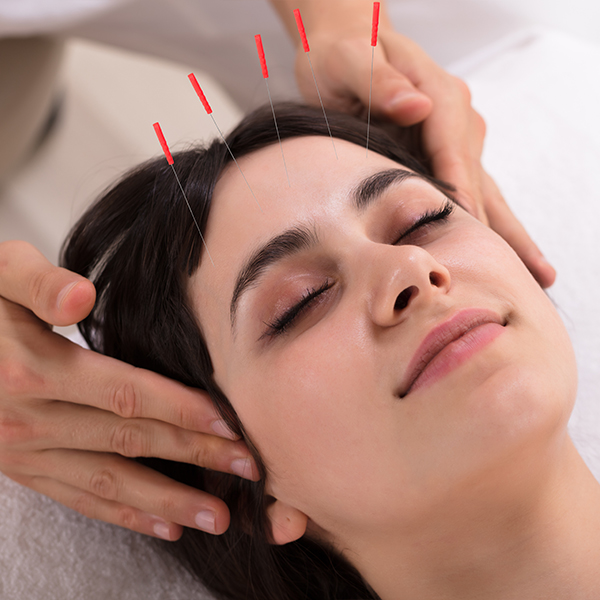 JunctionAcu | Service - Cosmetic Acupuncture