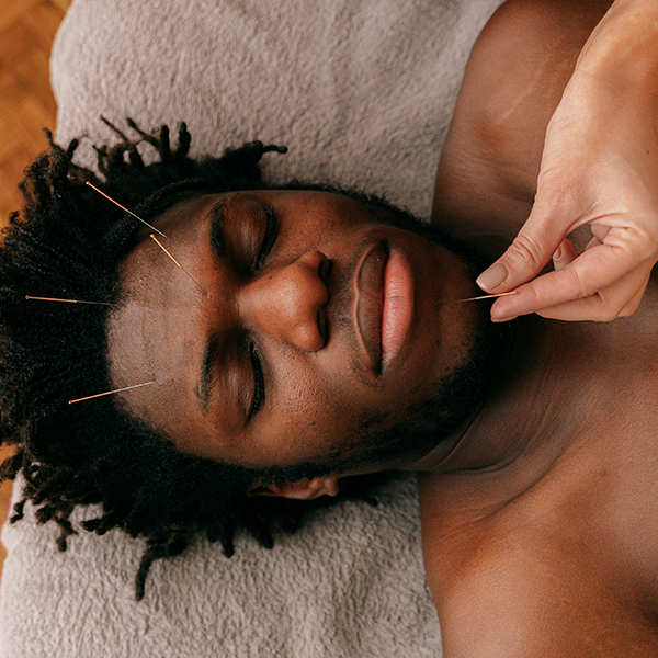 JunctionAcu | Service - Cosmetic Acupuncture